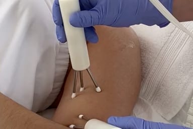 Body Resculpting Treatment at Tracie Martyn Spa 